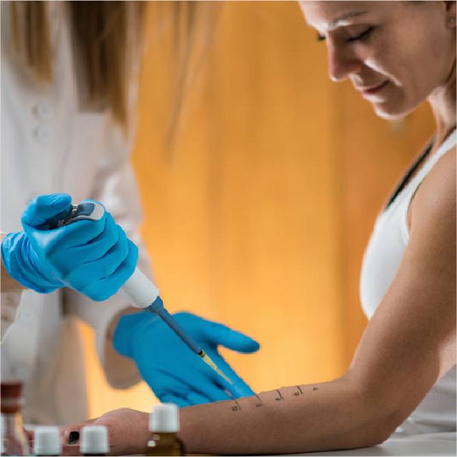 A woman undergoing an allergy test.